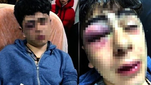 14 yaşındaki çocuğu darbeden 5 polis hakkında karar verildi