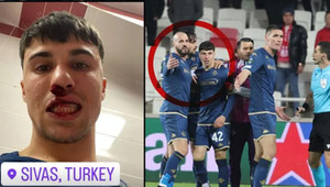 Sivasspor taraftarı sahada Bianco’nun burnunu kırdı