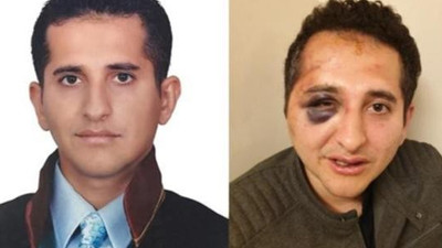 Erdoğan'ın korumalarının darp ettiği avukat isyan etti: Doktor için bile evden çıkamıyorum