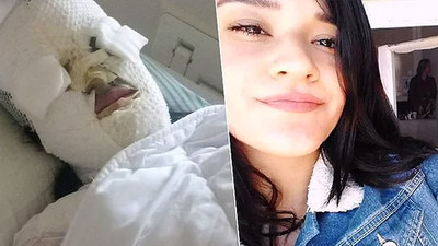 Yüzüne asit atılan Berfin için CHP'den yasa teklifi