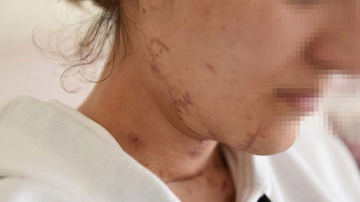 İşkence yaptı, tecavüz etti, boğazını kesti, arabayla üzerinden geçti...