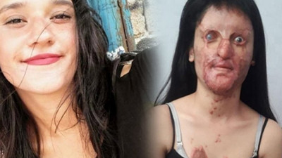 'Bir erkeğe ‘hayır’ dediğim için öldürülmek istendim'