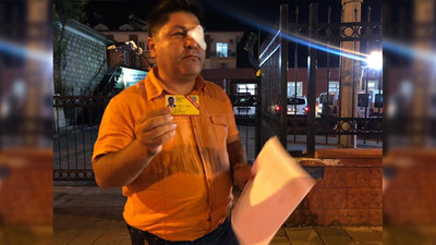 Gazeteci Mesut Bölük'e saldırı