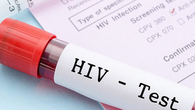HIV virüsü yok edilebilir
