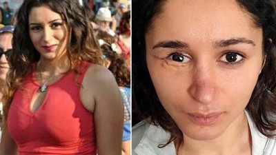 İzmir'de kan donduran olay! Genç kadın kabusu yaşadı