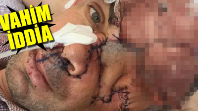 Dişini çektirdikten sonra bu hale geldi