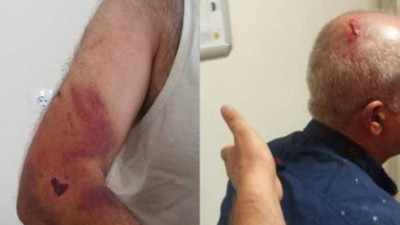 Engelli kız ve babasına ‘Bana niye oy vermedin’ dayağı