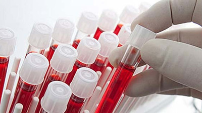 Kansere karşı en dirençli kan grubu belli oldu