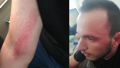 Doktordan özel harekat polislerine darp suçlaması