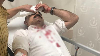 Sendika başkanına muştalı saldırı