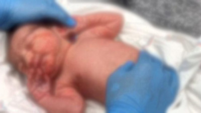 Annesinin uyuşturucu verdiği 10 aylık bebek hastaneye kaldırıldı