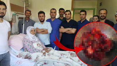 Kalbinden 400 gramlık tümör çıkarıldı