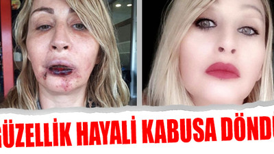Güzellik uğruna hayatı karardı