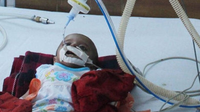 Kızamık salgınında ölü sayısı 76'ya yükseldi