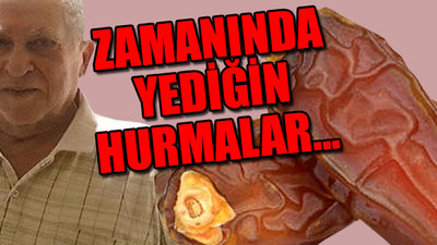 Bağırsağını tıkayan hurma çekirdekleri çıkarıldı