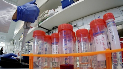 İki Rus enstitüsünde koronavirus aşısı geliştiriliyor