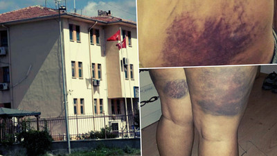 Karakolda işkence: Bugün sporumu üzerinizde yaptım!