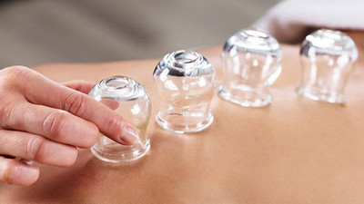 Hacamat ve sülük tedavisi yapan sahte doktora 20 ay hapis