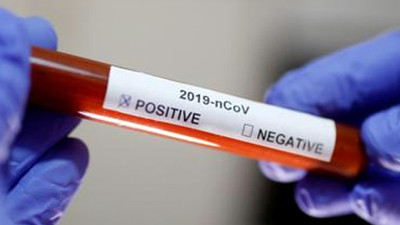 1 aylık bebeğe koronavirüs teşhisi