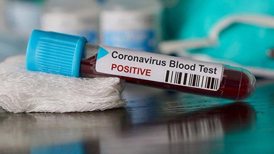 65 bin emekli sağlık çalışanı koronavirüs salgını nedeniyle göreve çağırılıyor