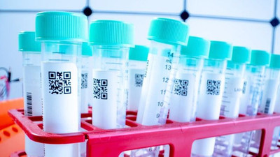 Fatih Altaylı: 10 ülkeye koronavirüs tespit kiti satan bir Türk firmasının giremediği tek ülke Türkiye