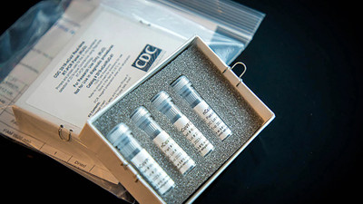 İrlandalı firma hızlı sonuç veren koronavirüs testi üretti