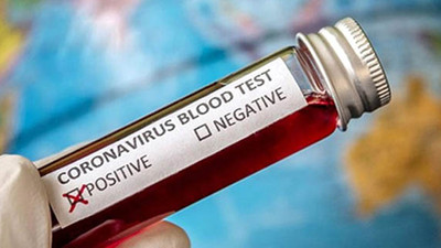 Koronavirüsü test sonuçları e-Nabız uygulamasında