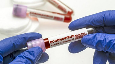 Rapor süresi 14 güne yükseltildi