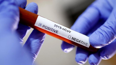 Zonguldak'taki banka işçisinde koronavirüs tespit edildi