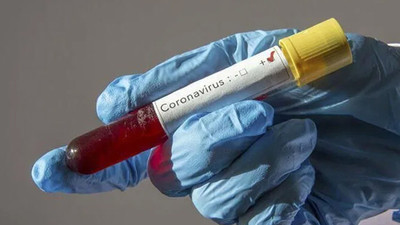 Almanya'da koronavirüs tedavisi için yeni yöntem