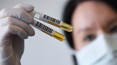 Kritik uyarı: Sosyal medyada plazma aramayın