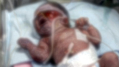 Çöp konteynerine bırakılan 1 günlük bebeği atık kağıt işçisi çocuklar buldu