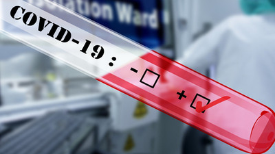 Erzurumspor'da 11 koronavirüs vakası