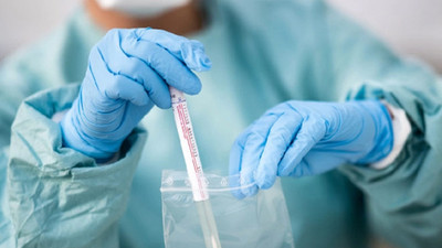 Prof. Dr. Kayıhan Pala: Ön tanıya girmiş koronavirüs vaka sayısı 600 binin üzerinde