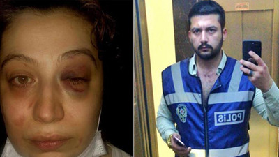 Eski eşinin şiddetine maruz kalan kadın: Can güvenliğim yok