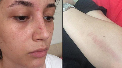 Şort giydiği için saldırıya uğradı