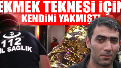 AKP'li belediye, tezgahına el koymuştu: Kendini yakan seyyar satıcı yaşam mücadelesini kaybetti