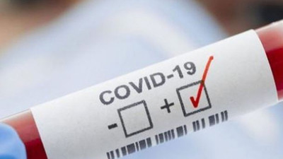 Fabrikada çalışan 155 işçiden 43'ünde koronavirüs tespit edildi