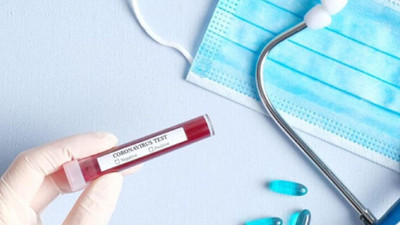 Milliyet, ATV ve DHA’da 6 çalışan koronavirüse yakalandı