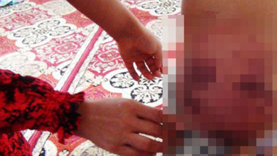 Şanlıurfa'da cani baba 4 çocuğunu kemer ve sopayla hastanelik etti