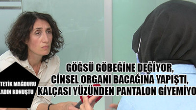 1.5 yılda 6  ameliyat geçirdi, hayatı kabusa döndü