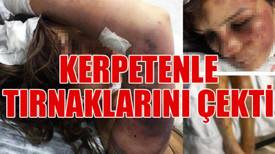Eve kilitledi işkence yaptı, kadın yoğun bakımda