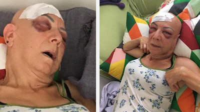 Kayınvalidesini vurdu sadece '8 yıl' ceza aldı