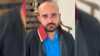 Kayseri'de boşanma davası öncesi avukata saldırı