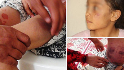 Sopa, kemer ve sıcak çayla işkence yapan baba için sadece '5 yıl' hapis istendi