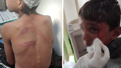 10 yaşındaki çocuğa öldüresiye dövüp tehdit ettiler