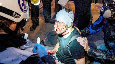 Gazeteciye ölümüne dayak