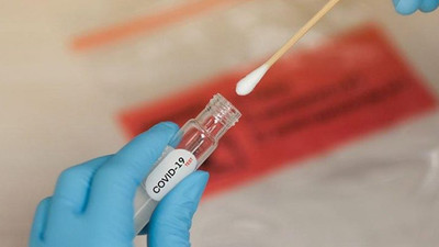 'İstanbul'da sadece bir mahallede 2200 vaka var'