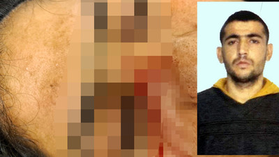 Kahvaltı hazırlamadığı gerekçesiyle birlikte yaşadığı kadını darp edip bıçakladı