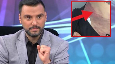 Alişan'dan doktora 2 milyonluk dava